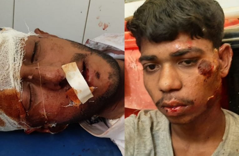 दो बाइकों की सीधी टक्कर से 2 व्यक्ति गंभीर रूप से घायल.