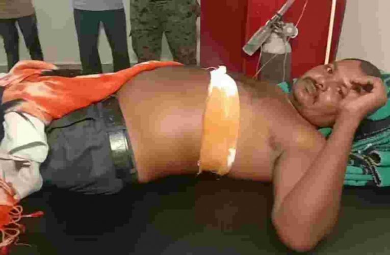 चतरा में अज्ञात अपराधियों ने बाइक सवार को मारी गोली,घायल