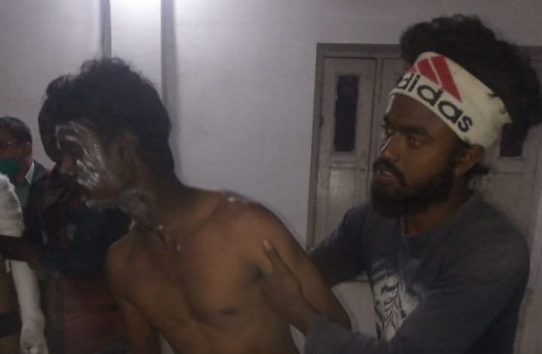 बीएमएल फैक्ट्री में ट्रांसफर चिउट फटने से एक दर्जन से अधिक झुलसे.