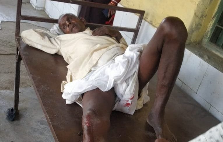 स्कार्पियो के धक्के से घायल वृद्ध की हालत गम्भीर , बेहतर ईलाज के लिए चिकित्सकों ने किया रेफर.