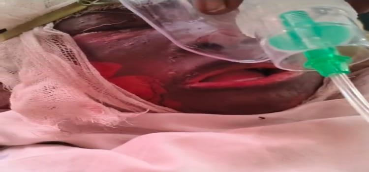 प्रेमी के धोखा देने पर प्रेमिका ने खुद को प्रेमी के घर के सामने किया आग के हवाले ! सुनिए प्रेमिका के अंतिम समय का बयान 20250218_184823