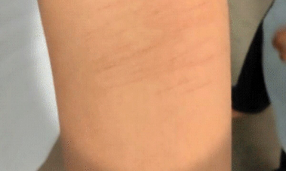 छत्तीसगढ़ के धमतरी जिले में सरकारी स्कूल में 35 छात्रों ने ब्लेड से काटे अपने हाथ, जांच में सामने आया हैरान करने वाला खुलासा! 14 20260219 205600