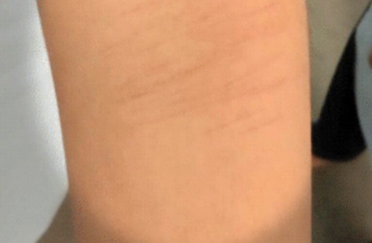 छत्तीसगढ़ के धमतरी जिले में सरकारी स्कूल में 35 छात्रों ने ब्लेड से काटे अपने हाथ, जांच में सामने आया हैरान करने वाला खुलासा!