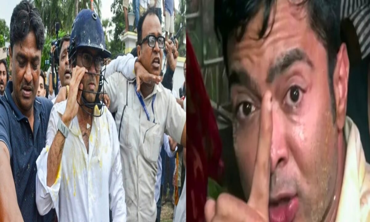 attack-in-abhishek-benarjee