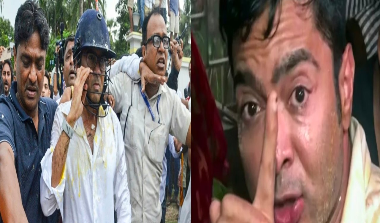 attack-in-abhishek-benarjee